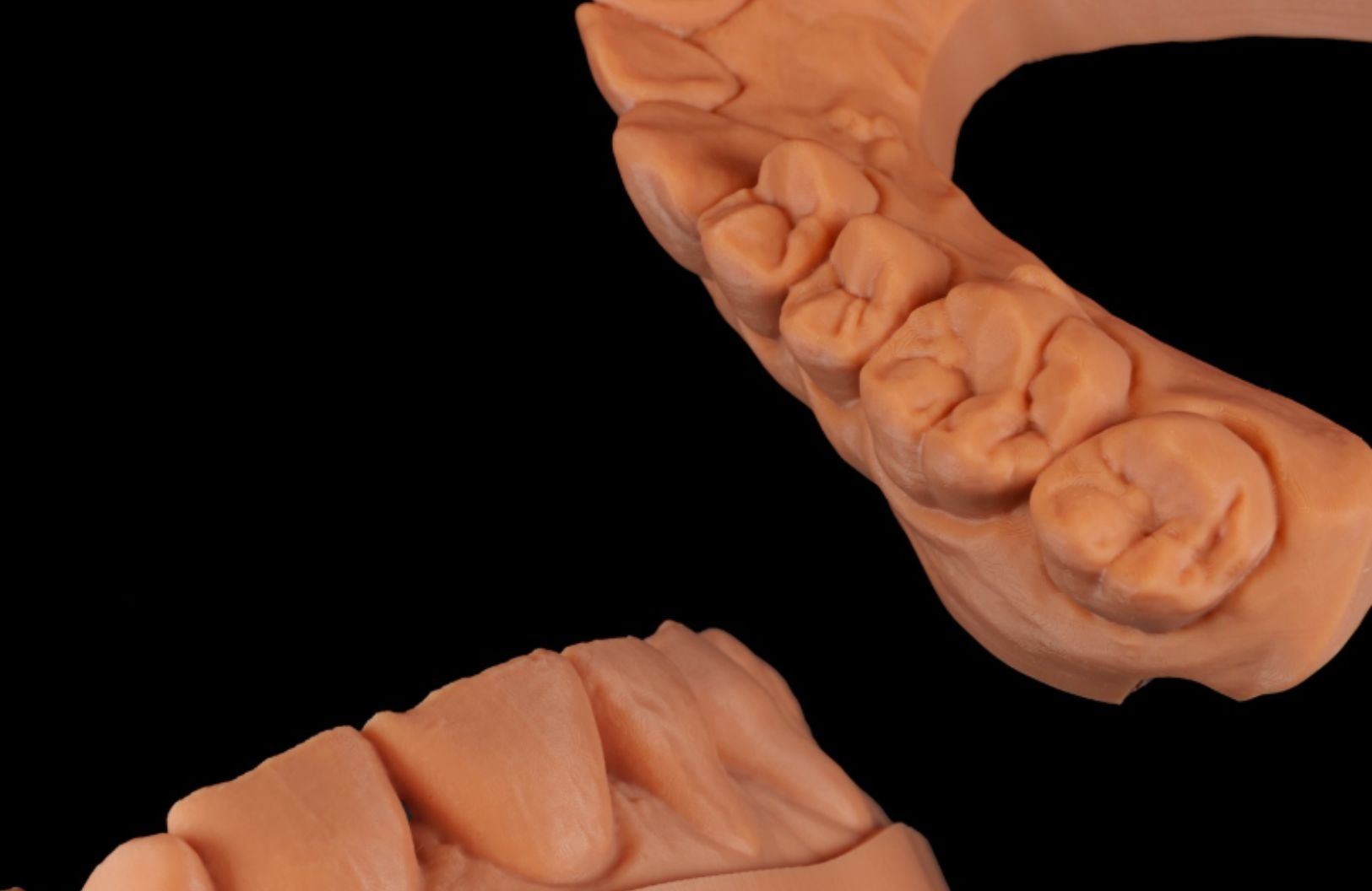 splint_2__75__6a51b66e4ed10.jpg