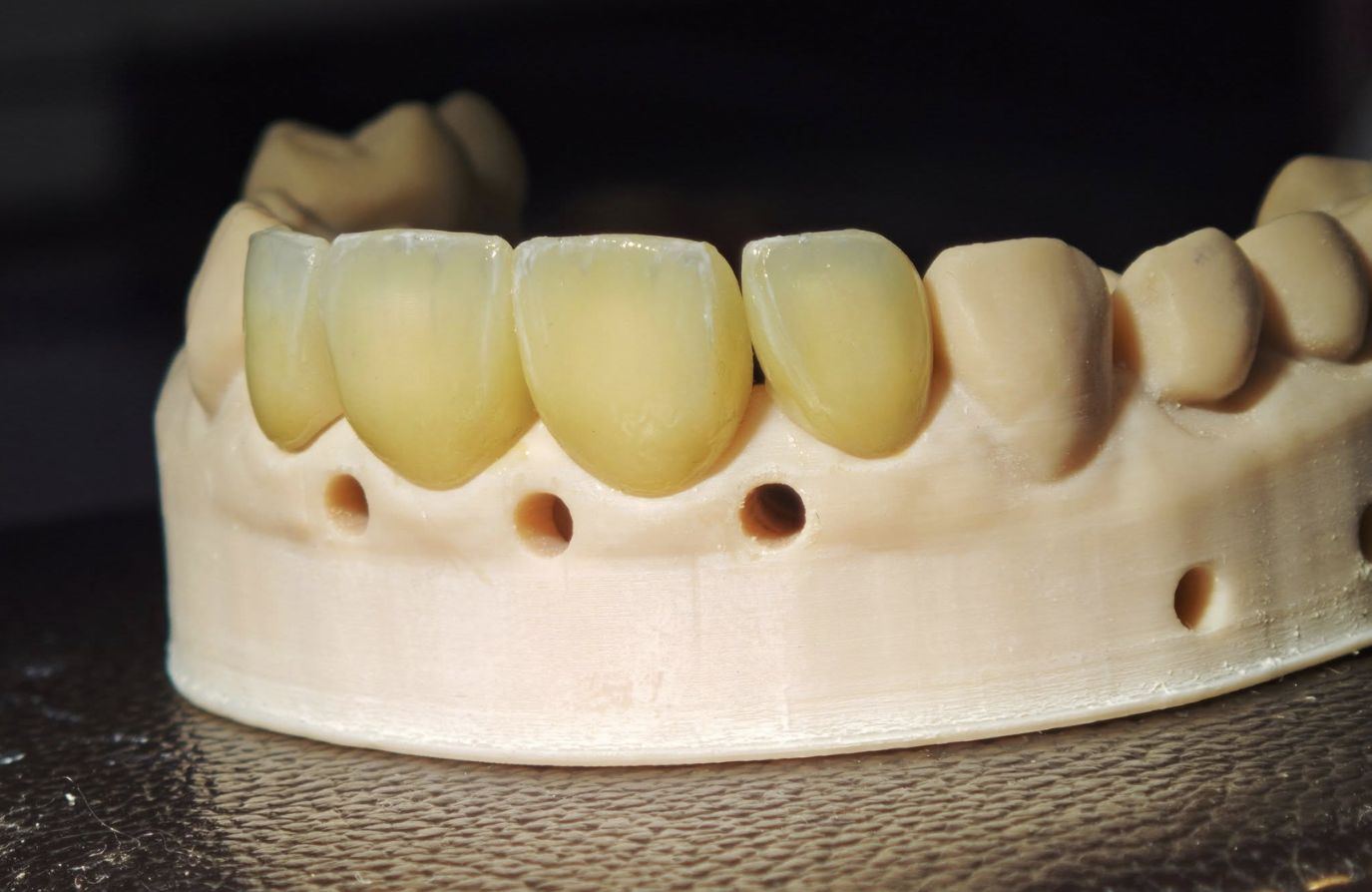 346_6a41e4454330e.jpg
