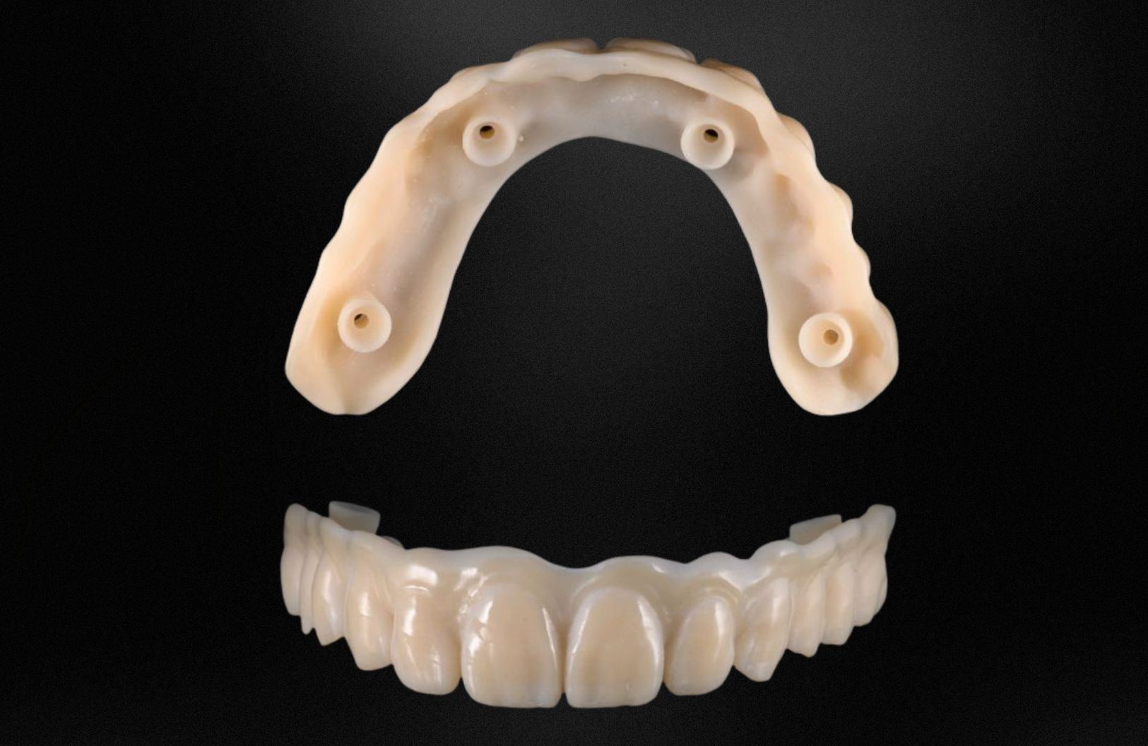 splint_-_2026-06-28T162953_310_6a419261a6390.jpg
