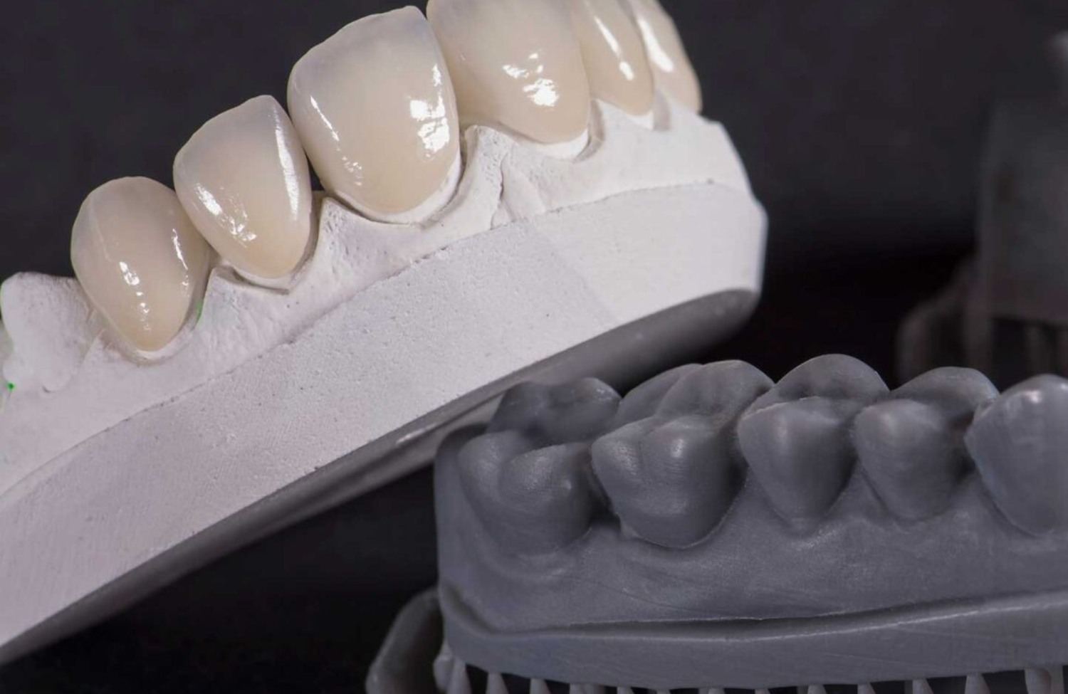 splint_-_2026-06-29T000148_637_6a41fca705daa.jpg