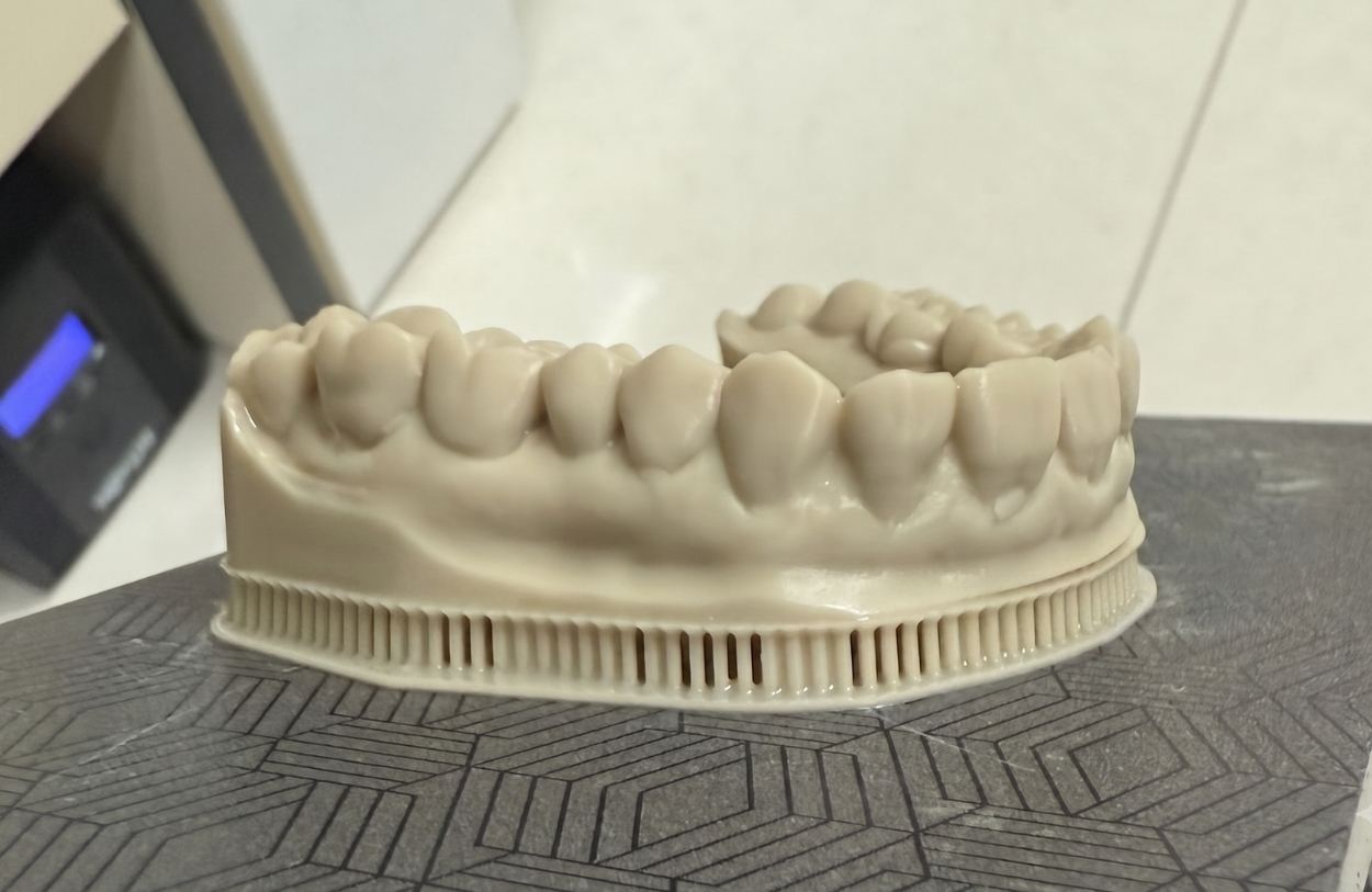 splint_2__30__6a42e24e11a0f.jpg