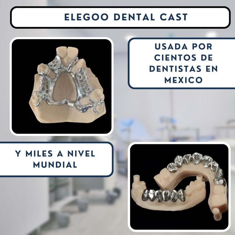 Elegoo Castable Dental - Imagen 4
