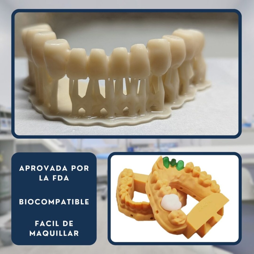 Jamg He Temp Crowns & Bridges - Imagen 5
