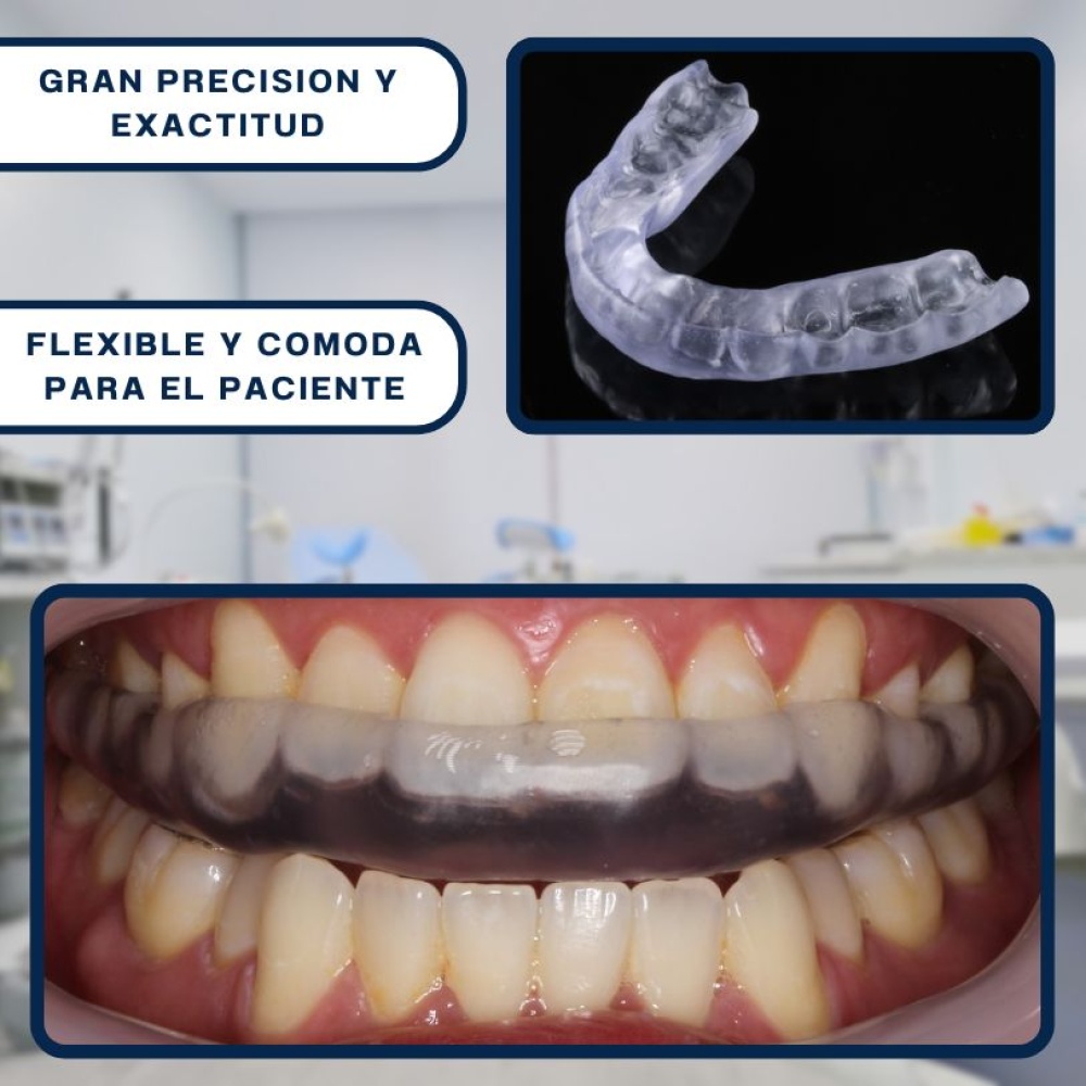 Senertek Splint Flex - Imagen 2