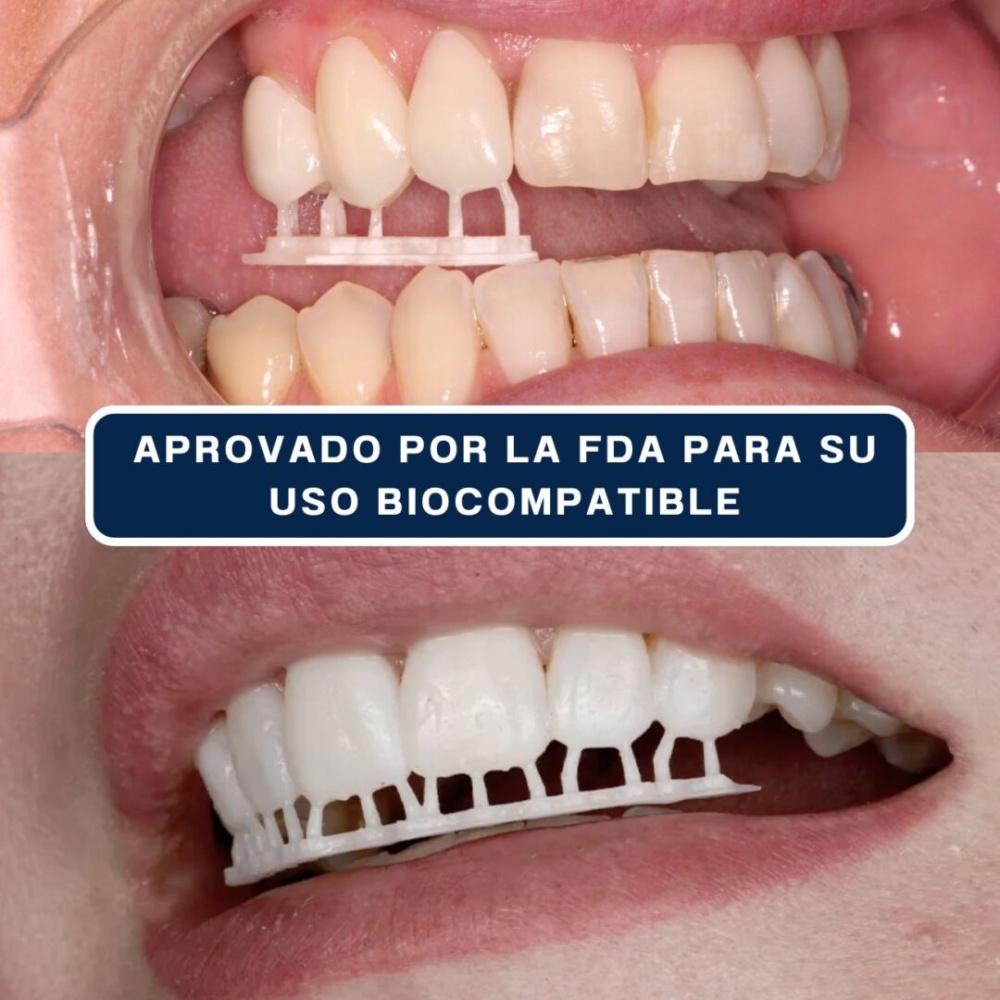 Senertek Snap On Smile - Imagen 5