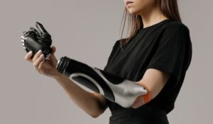 Prótesis con impresión 3D